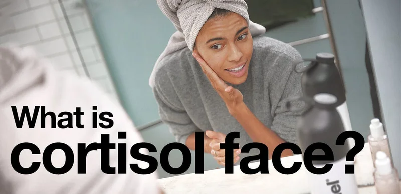 What is cortisol face?