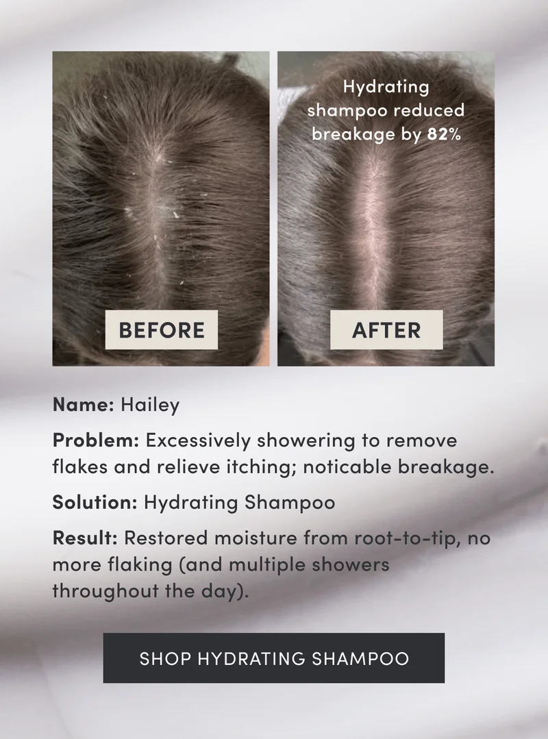 Hydrating shampoo reduced breakage by 82% | Name: Hailey | Problem: Excessively showering to remove flakes and relieve itching; noticable breakage. | Solution: Hydrating Shampoo | Result: Restored moisture from root-to-tip, no more flaking (and multiple showers throughout the day). | Shop Hydrating Shampoo