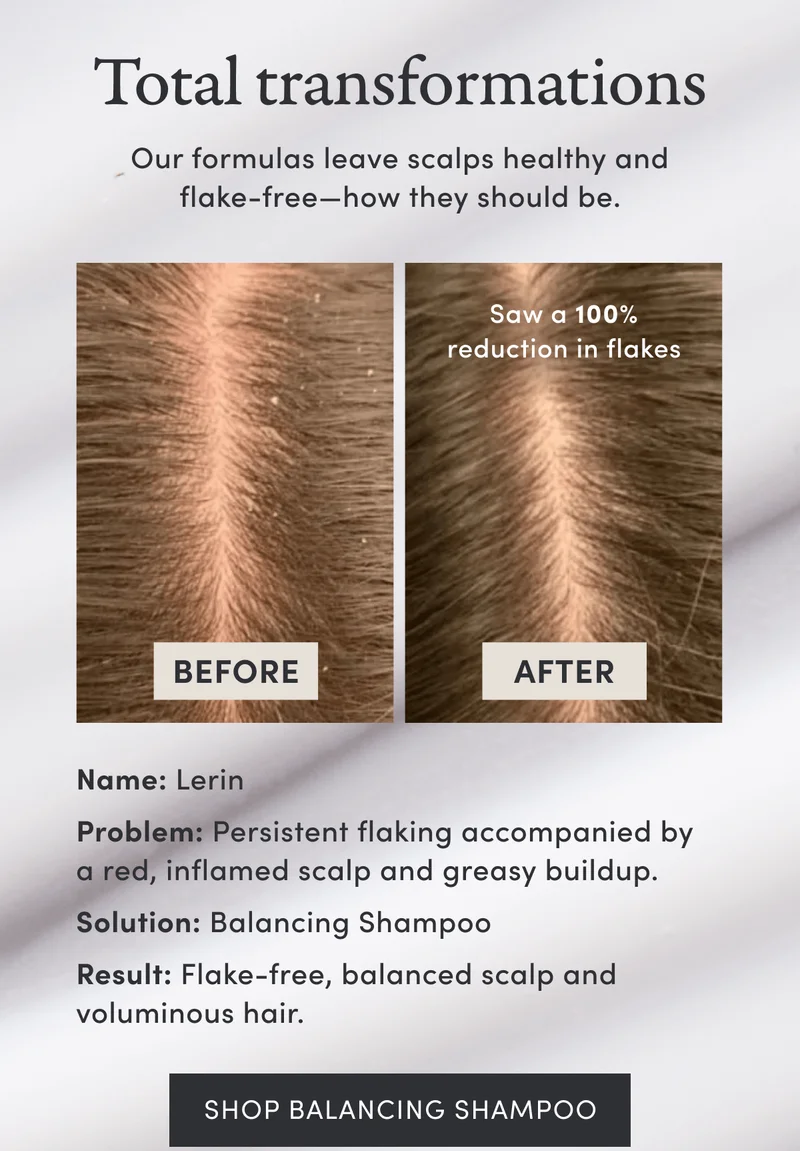 Total transformations | Our formulas leave scalps healthy and flake-free—how they should be. | Saw a 100% reduction in flakes | Name: Lerin | Problem: Persistent flaking accompanied by a red, inflamed scalp and greasy buildup. | Solution: Balancing Shampoo | Result: Flake-free, balanced scalp and voluminous hair. | Shop Balancing Shampoo