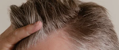 Get a personalized treatment recommendation