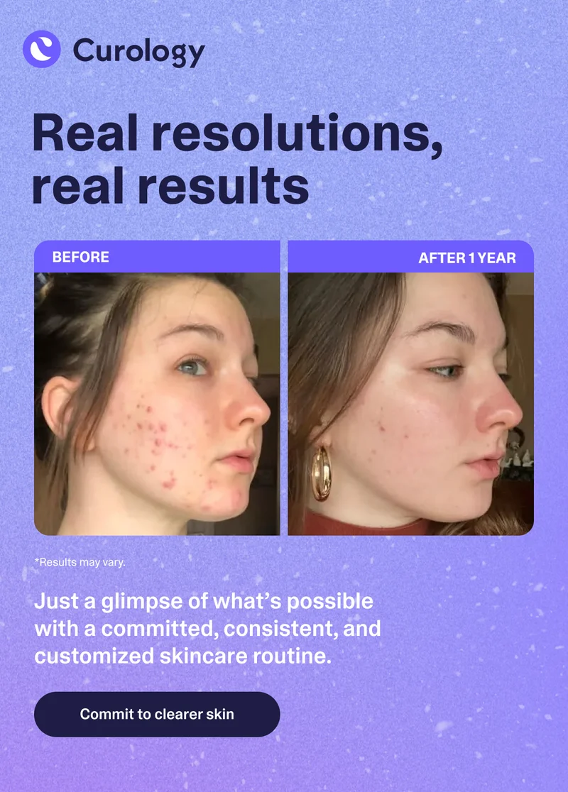Commit to better skin
