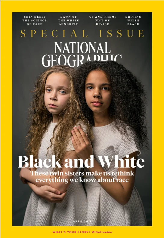 Marcia (left) and Millie Biggs say people are shocked to learn that they’re fraternal twins. Marcia looks more like their mother, who’s English born, and Millie looks more like their father, who’s of Jamaican descent.