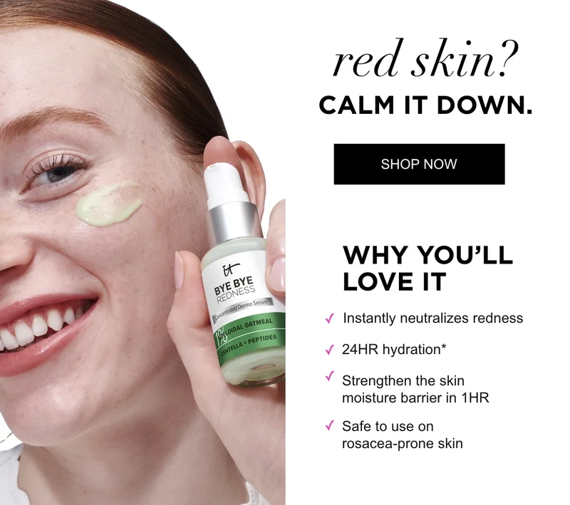 red skin? CALM IT DOWN