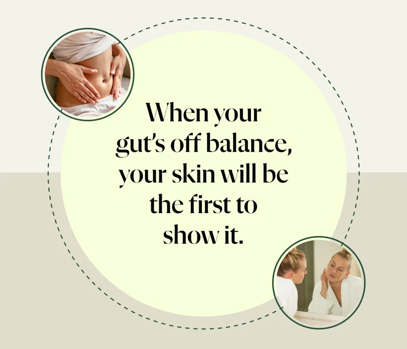 When your gut’s off balance, your skin will be the first to show it.