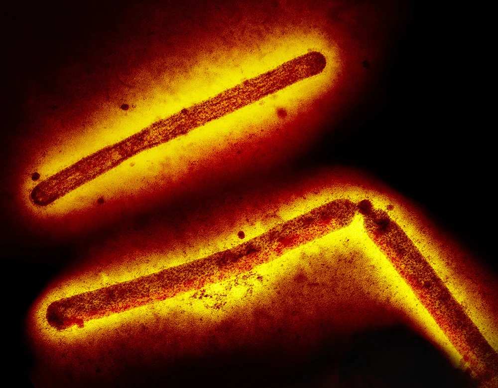 A colorized, microscopic view of H5N1 bird flu particles, which appear as red rods encapsulated by a yellow glow.