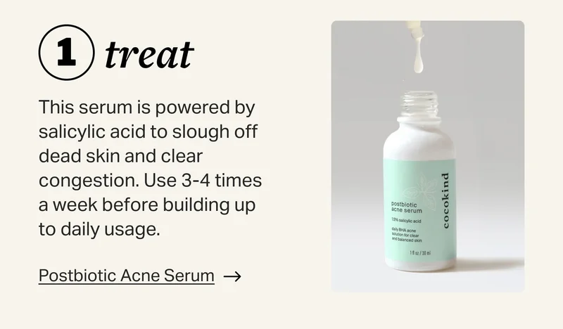 postbiotic acne serum