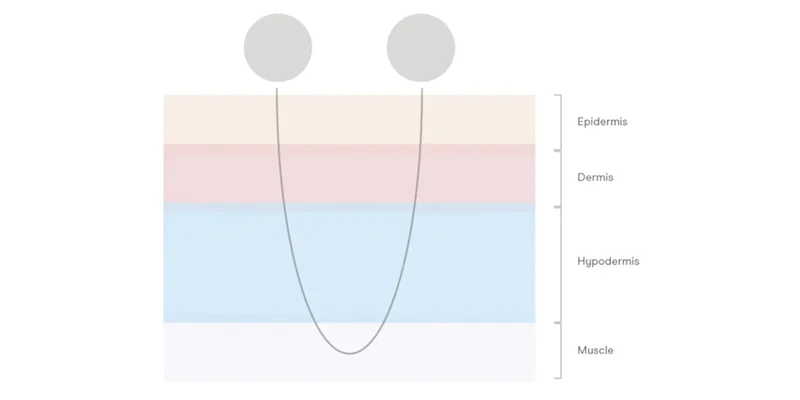 Skin Diagram