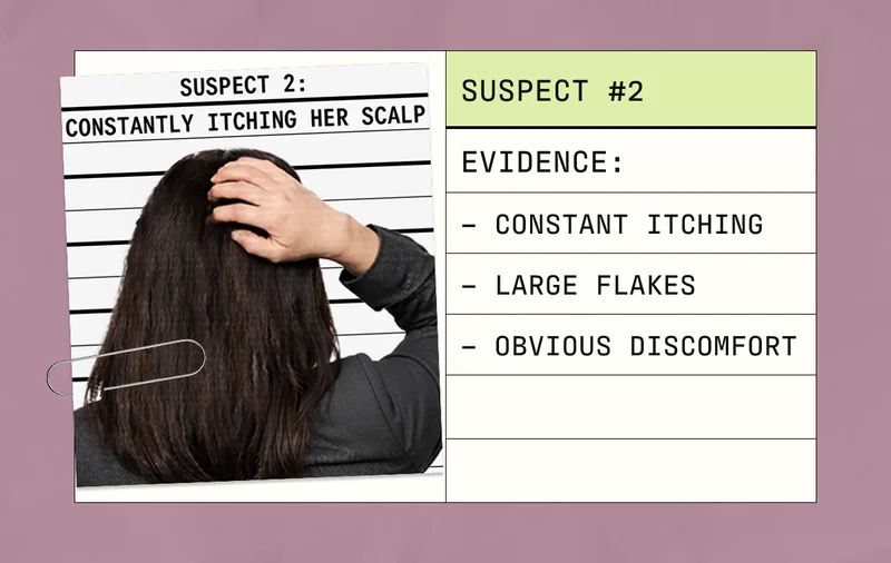 Suspect #2 | Evidence: Constant Itching, Large Flakes, Obvious Discomfort
