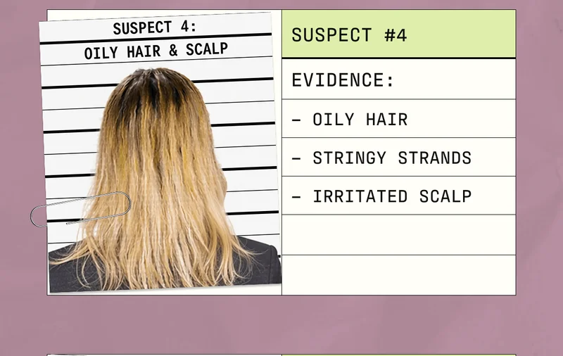 Suspect #4 | Evidence: Oily Hair, Stringy Strands, Irritated Scalp