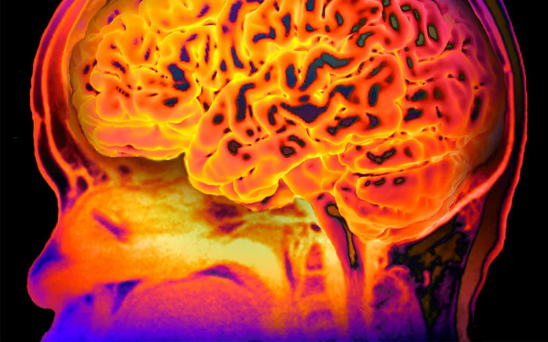 A colorized 3D MRI scan maps the neural networks inside a child’s brain. A new study found three distinct ADHD biotypes, each tied to unique patterns of brain connectivity.