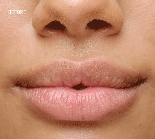 Before & After Results