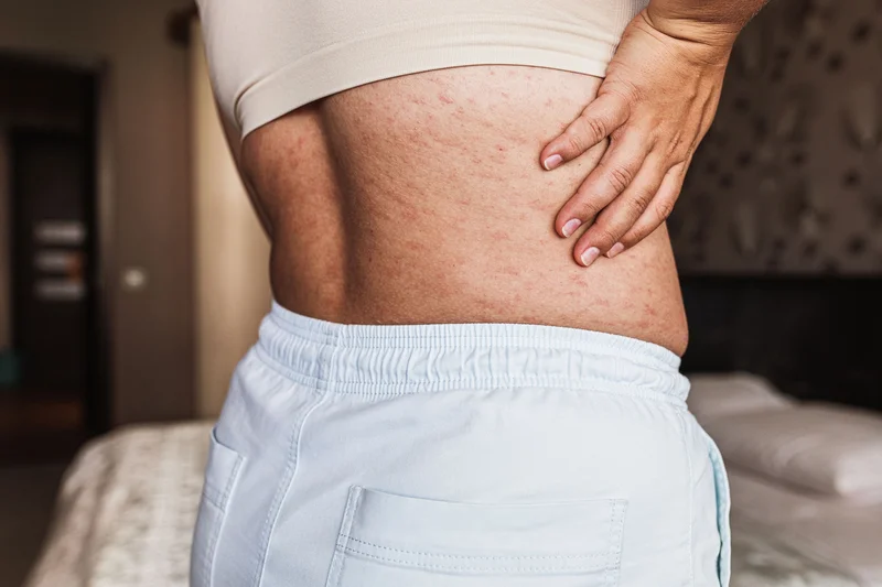 When the immune system malfunctions and attacks its own cells, this can cause more than 80 types of autoimmune diseases, such as lupus, multiple sclerosis, and rheumatoid arthritis. Dermatomyositis, an autoimmune disease that affects mostly women, is marked by the display of inflammation and rash.
