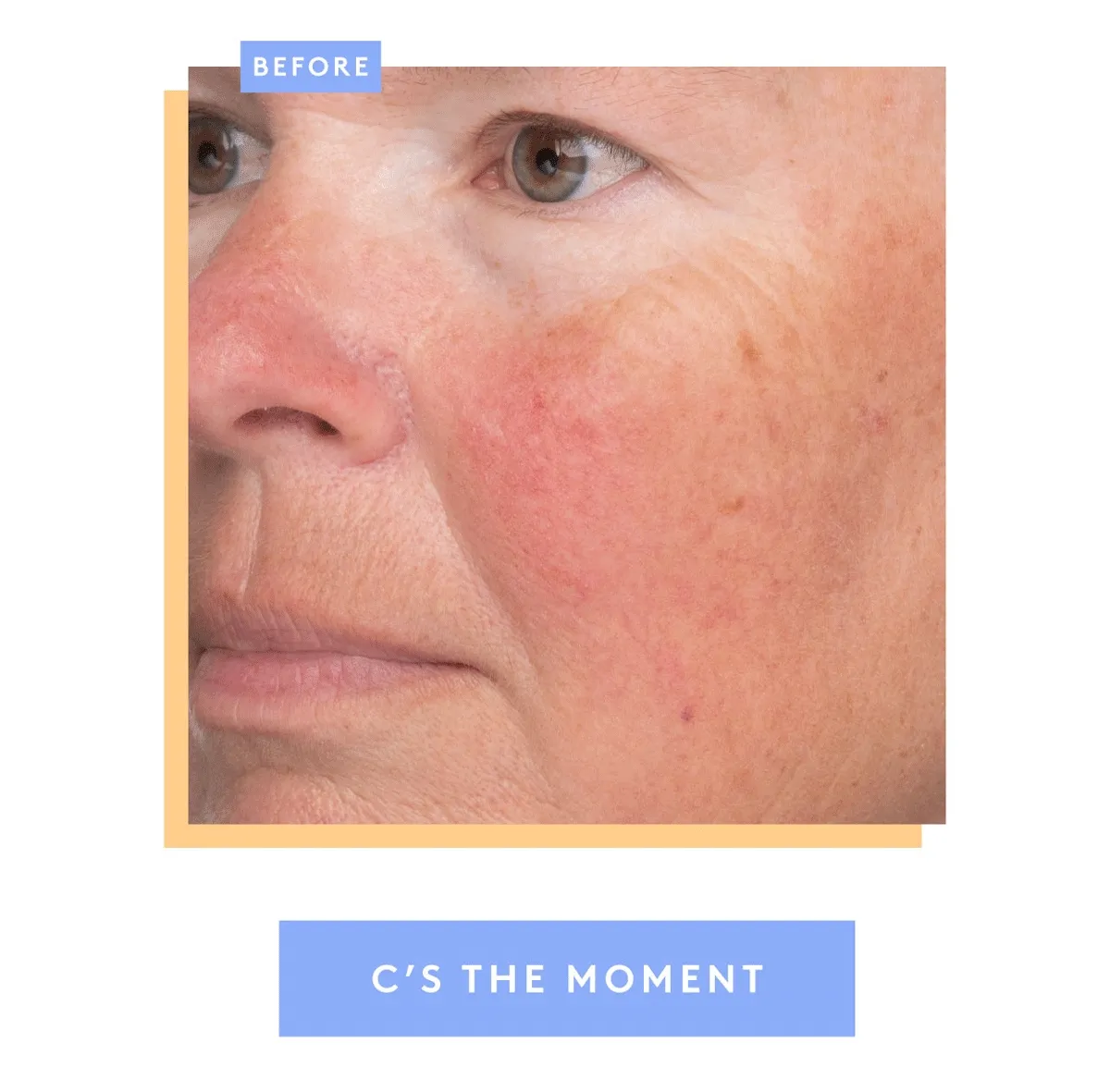 C-Luma B&A