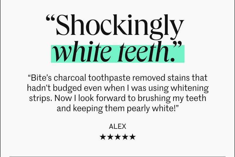 Shockingly White Teeth.