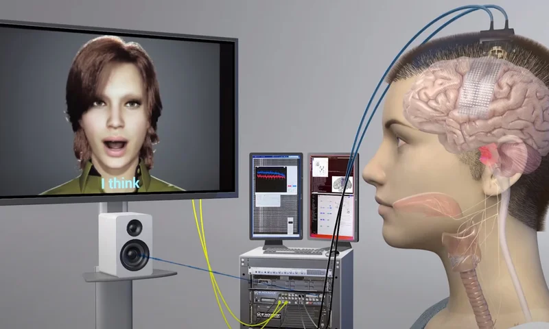 How a Brain Implant