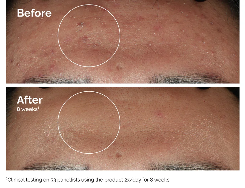 See the before and afters.
