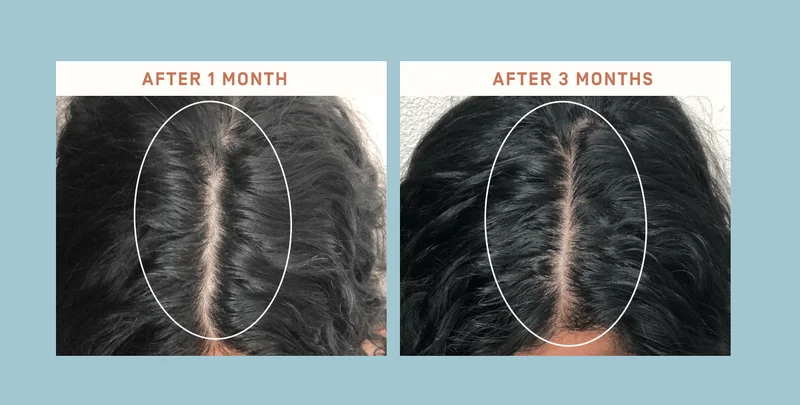 After 1 month / After 3 months
