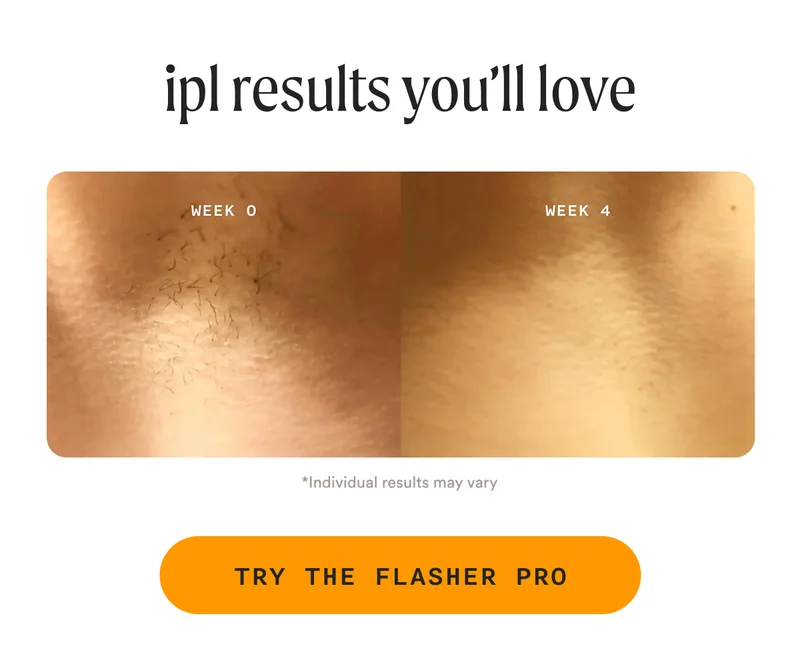 ipl results you'll live. - The Flasher Pro Before & After - TRY THE FLASHER PRO