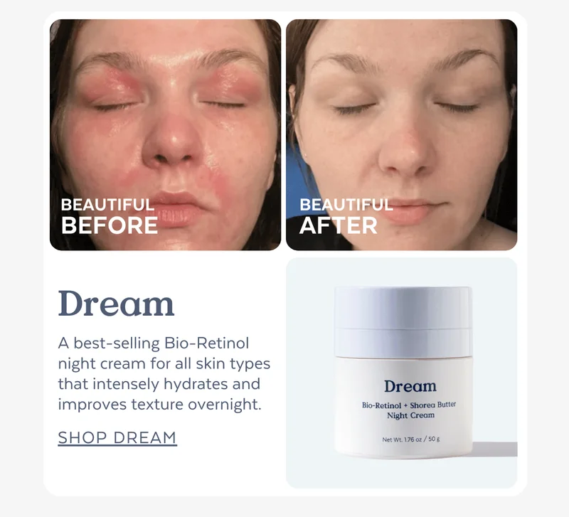 BEAUTIFUL BEFORE | BEAUTIFUL AFTER: Dream | A best-selling Bio-Retinol night cream for all skin types that intensely hydrates and improves texture overnight. [SHOP DREAM]