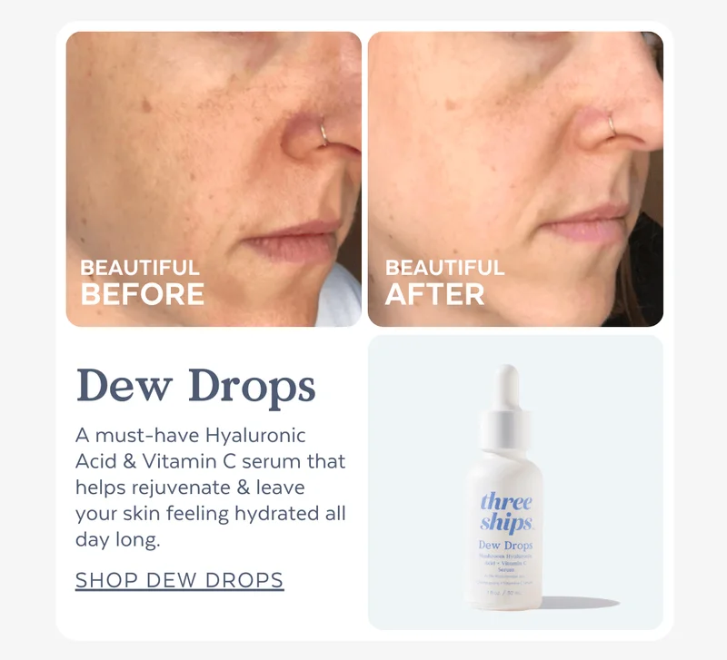 BEAUTIFUL BEFORE | BEAUTIFUL AFTER: Dew Drops | A must-have Hyaluronic Acid & Vitamin C serum that helps rejuvenate & leave your skin feeling hydrated all day long. [SHOP DEW DROPS]