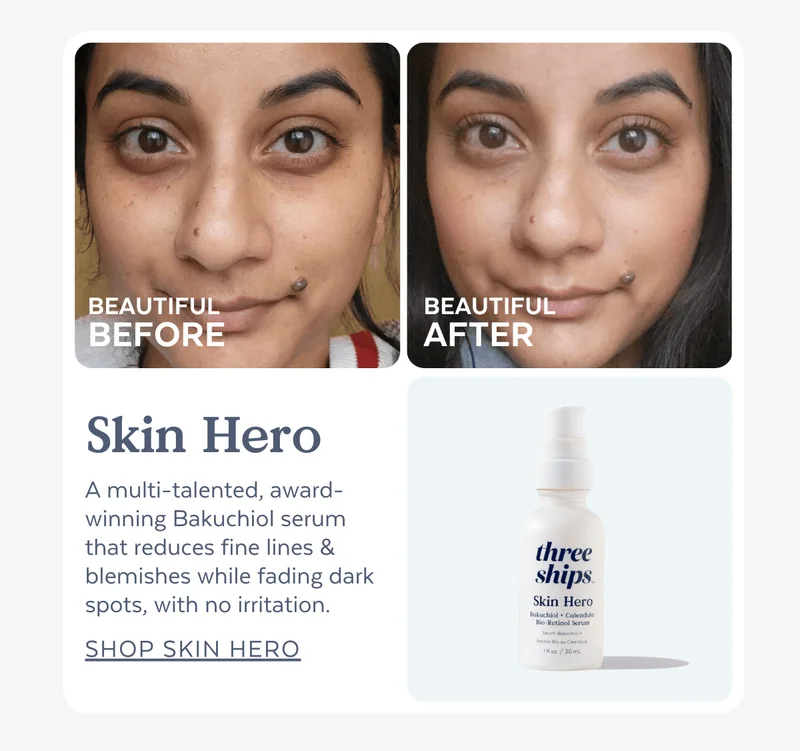 BEAUTIFUL BEFORE | BEAUTIFUL AFTER: Skin Hero | A multi-talented, award-winning Bakuchiol serum that reduces fine lines & blemishes while fading dark spots, with no irritation. [SHOP SKIN HERO]