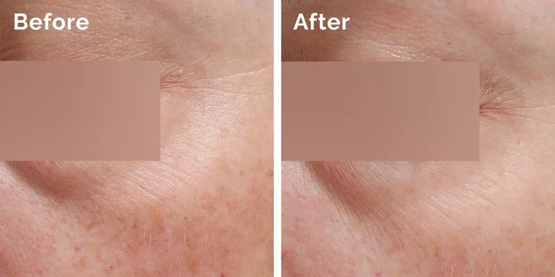 Before & After