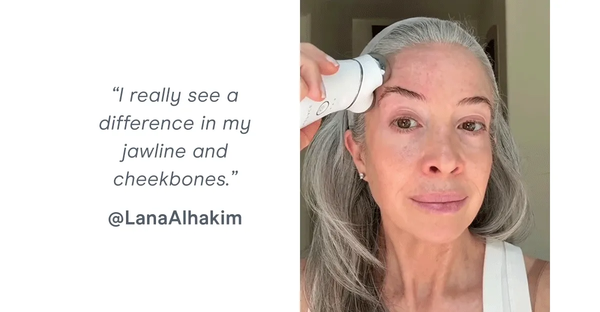 “I really see a difference in my jawline and cheekbones.” @LanaAlhakim
