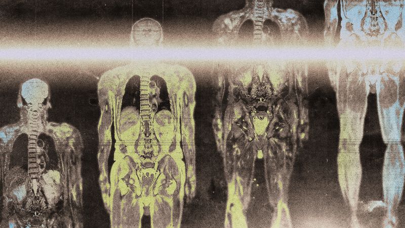body scan, Adult, Person, Wedding, and Alien