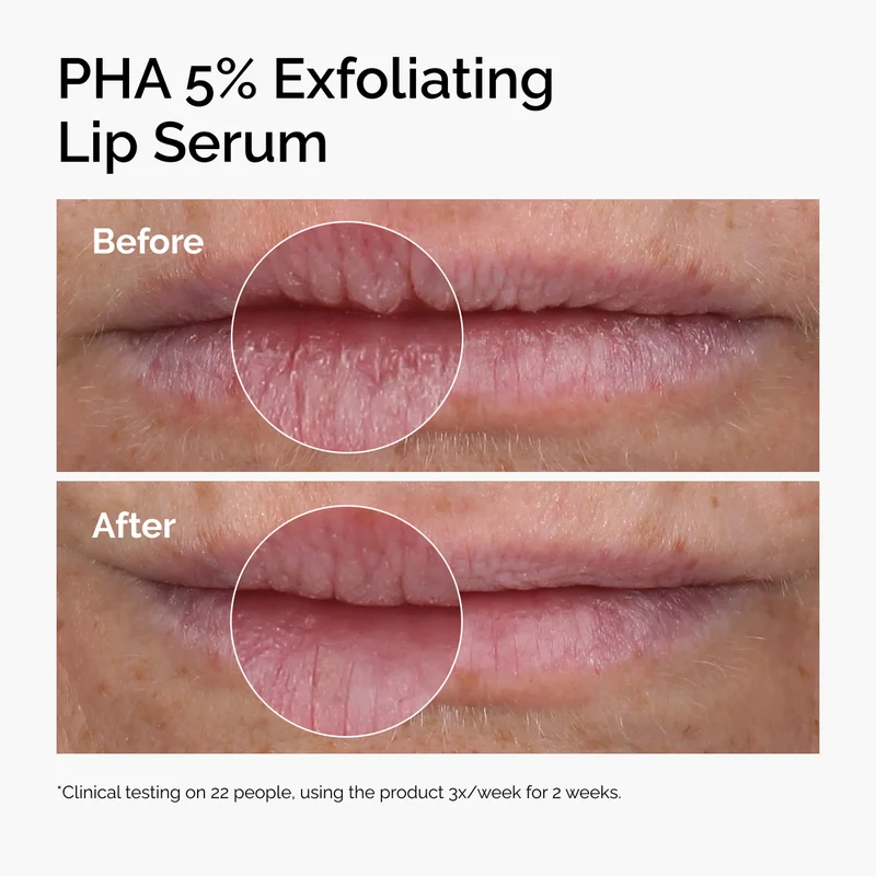 Experience the before and afters.
