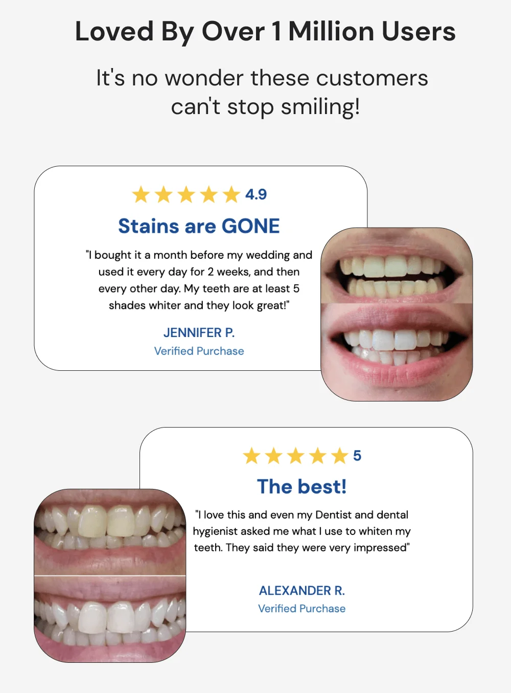 Loved By Over 1 Million Users. It's no wonder these customers can't stop smiling! "I bought it a month before my wedding and used it everyday for 2 weeks, and then every other day. My teeth are at least 5 shades whiter and they look great!"