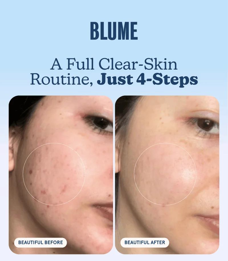BLUME: A Full Clear-Skin Routine, Just 4-Steps