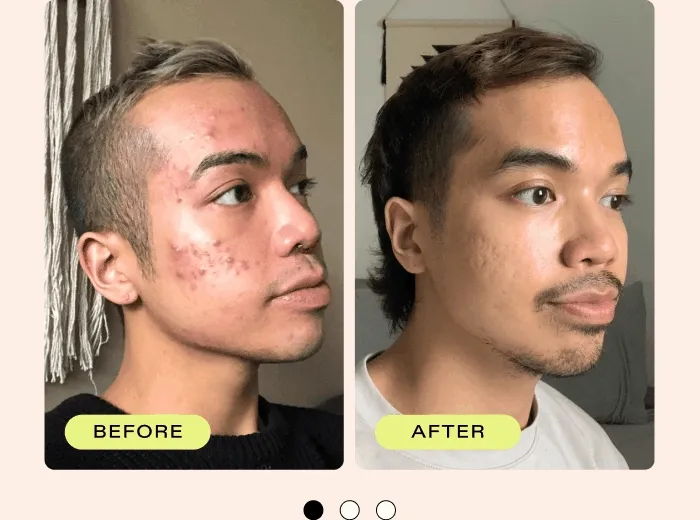 Before + After