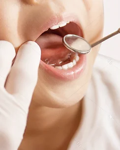 Close-up of kid's mouth being inspected by dentist