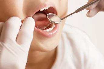 Close-up of kid's mouth being inspected by dentist