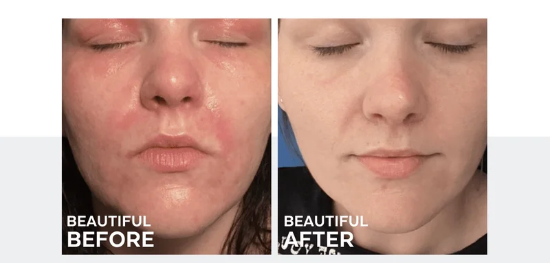 before/after