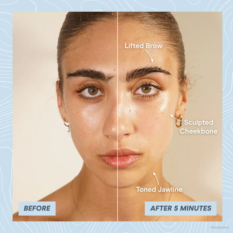 Cheyenne's Before & After Results showing lifted brow, sculpted cheekbone, and toned jawline.