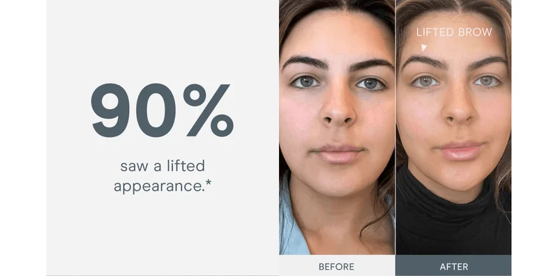 90% saw a lifted appearance.*