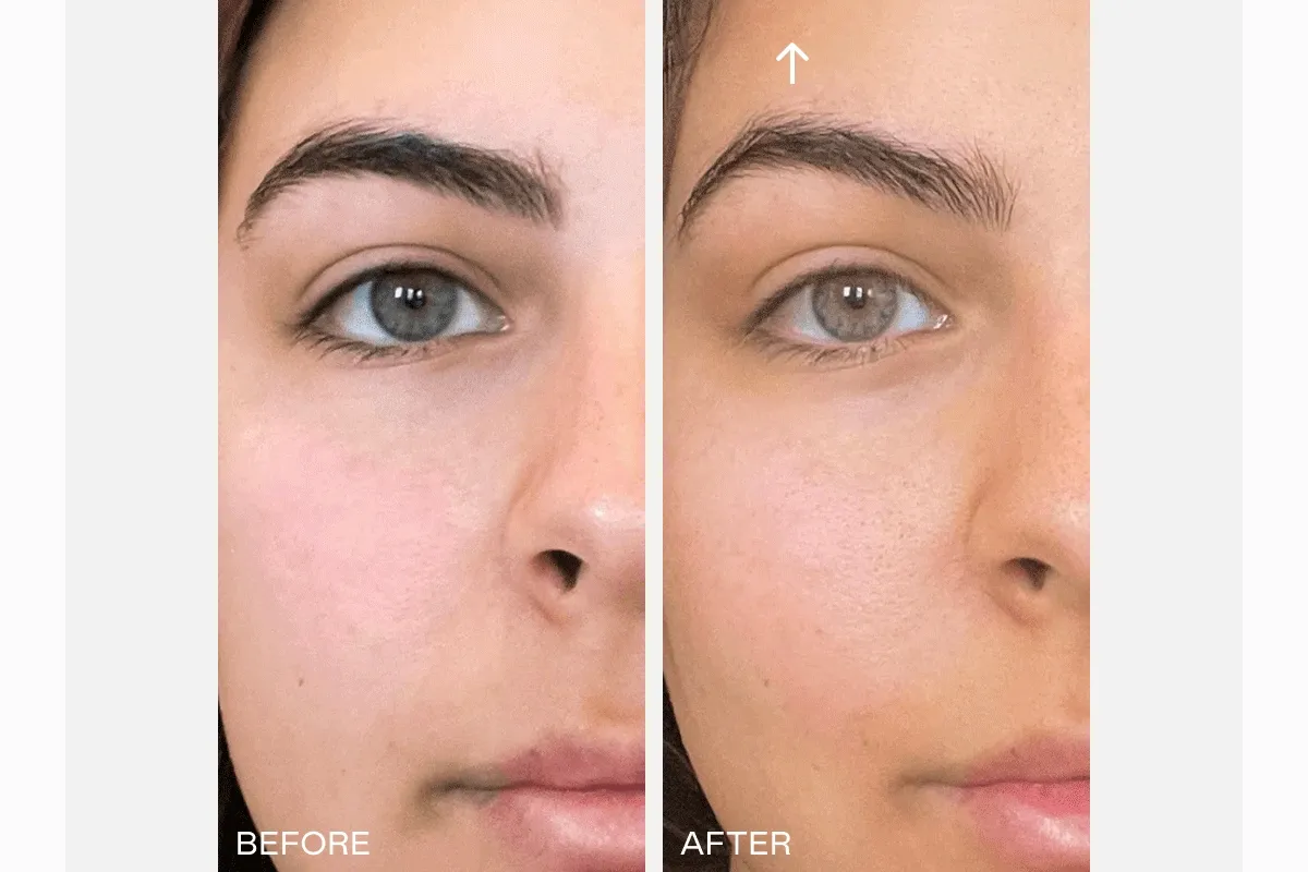 Before & After Showcase