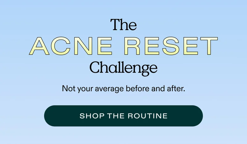 THE ACNE RESET CHALLENGE.  Not Your Average Before & After  |  SHOP THE ROUTINE