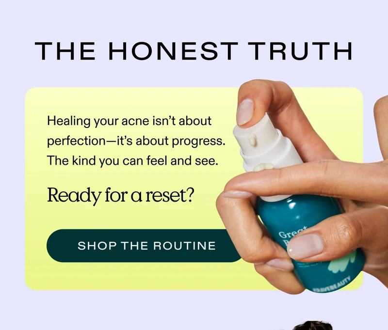 The Honest Truth. Healing your acne isn’t about perfection—it’s about progress. The kind you can feel and see.  Ready for a reset?  |  SHOP THE ROUTINE