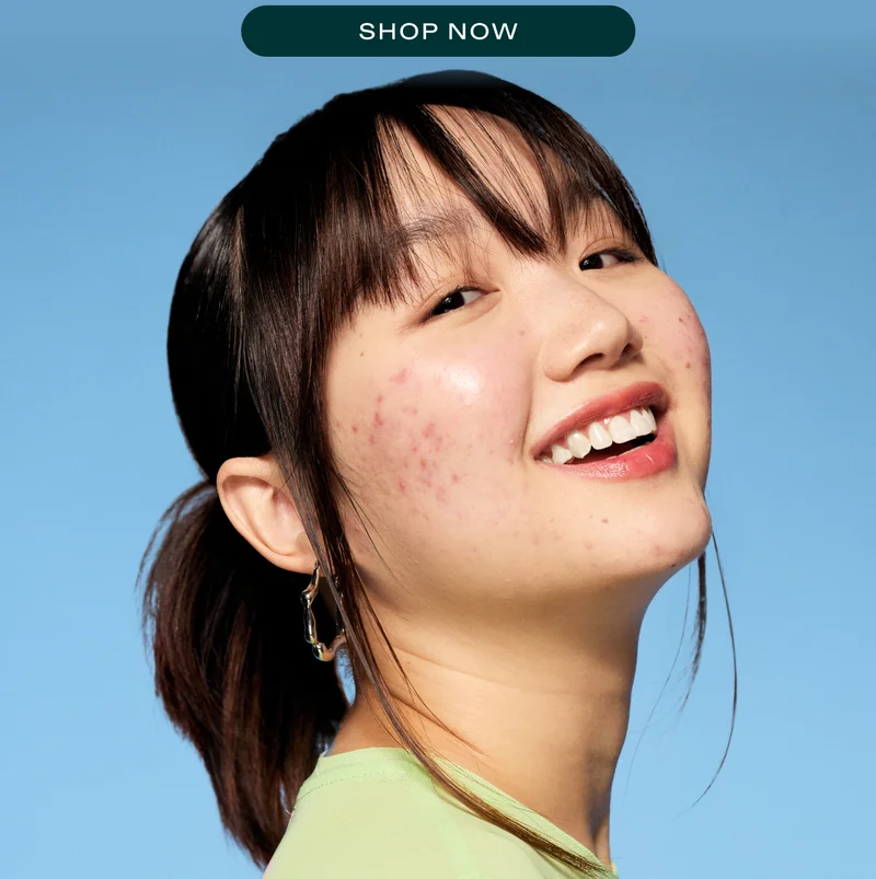 SHOP NOW