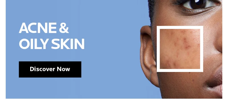 Acne Oily Skin Discover Now