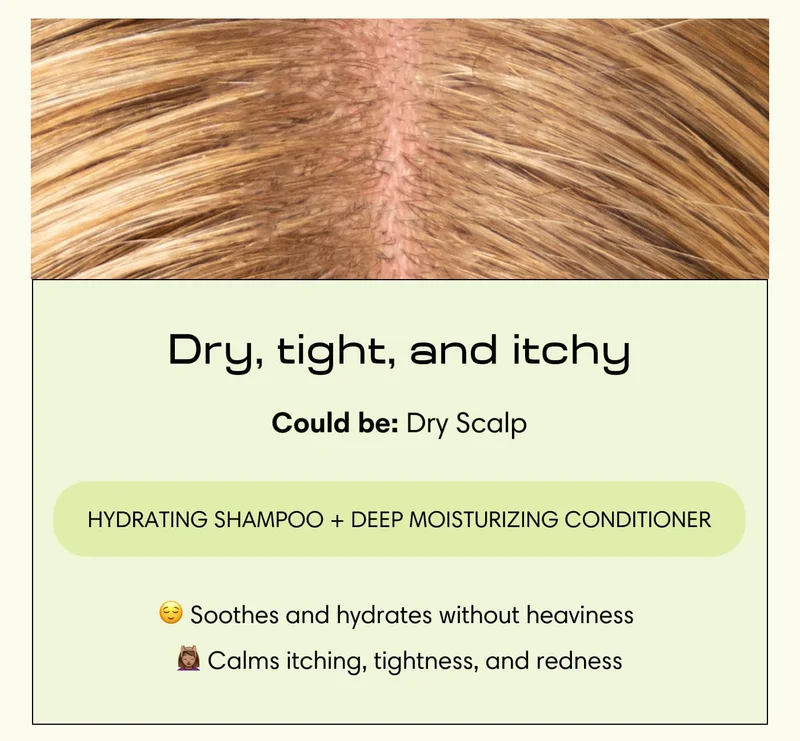 Dry, tight, and itchy Could be: Dry Scalp Hydrating Shampoo + Deep Moisturizing Conditioner - Soothes and hydrates without heaviness  - Calms itching, tightness, and redness