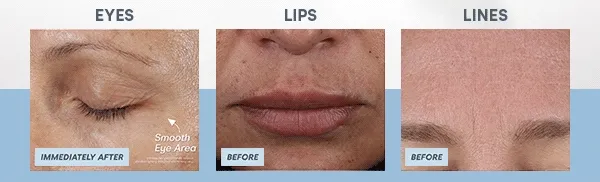 Don’t just take our word for it; the results speak for themselves!