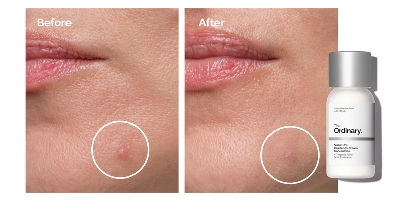 Shop Sulfur 10% Powder-to-Cream Concentrate.