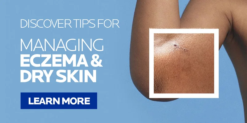 DISCOVER TIPS FOR ECZEMA & DRY SKIN