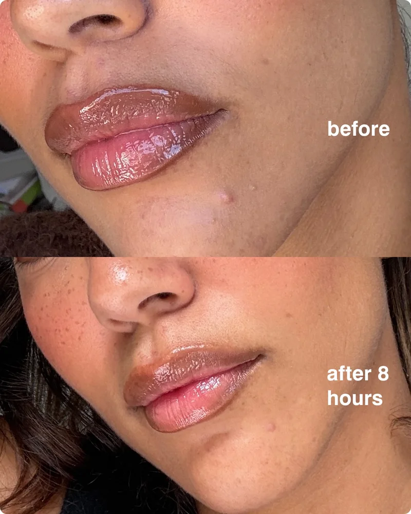 before, after 8 hours