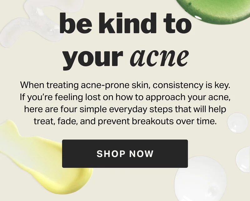 be kind to your acne SHOP NOW