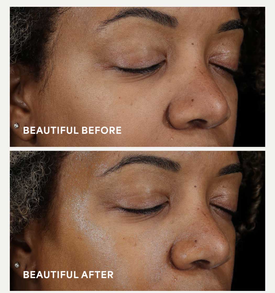 BEAUTIFUL BEFORE - BEAUTIFUL AFTER