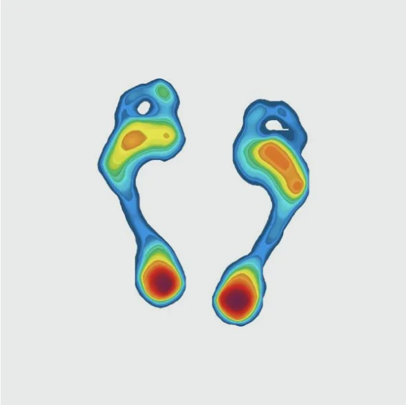 A heatmap of a woman's foot, visualizing data collected using a 3D scanner and pressure mapping tool.